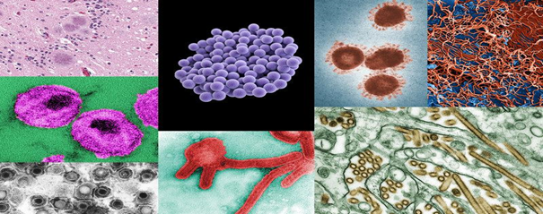 Most Common Infections caused by pathogens