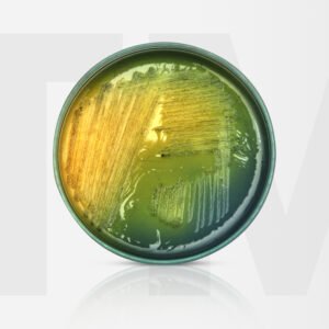 TCBS Agar for Vibrio Species: Principles and Practices - TM Media