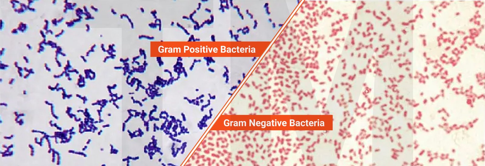 gram staining
